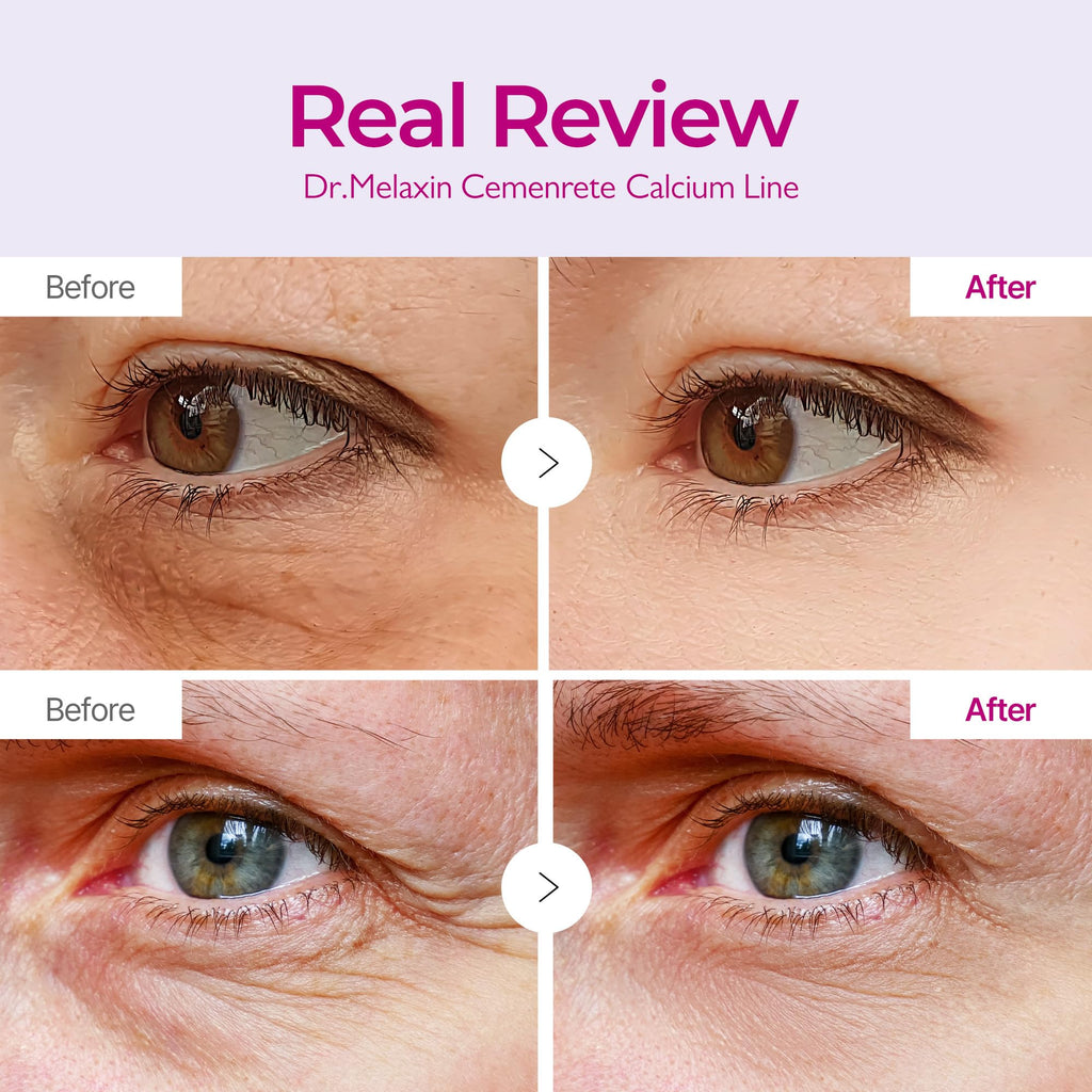 Dr.Melaxin - Calcium Volume Eye Patch - 72g (60 parches) | Parches de Hidrogel para Contorno de Ojos Reafirmantes