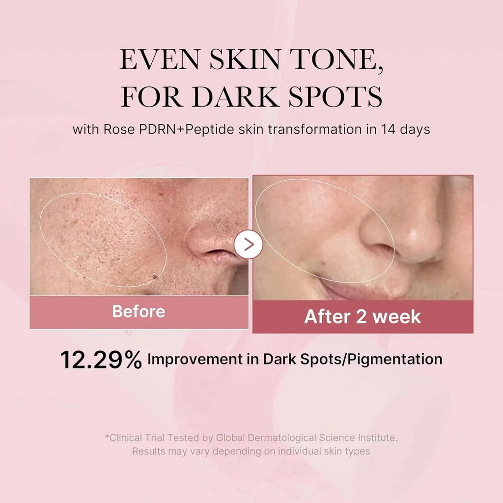 Medicube - PDRN Pink Niacinamide Milky Toner - 150ml | Tónico Facial Iluminador y Reparador