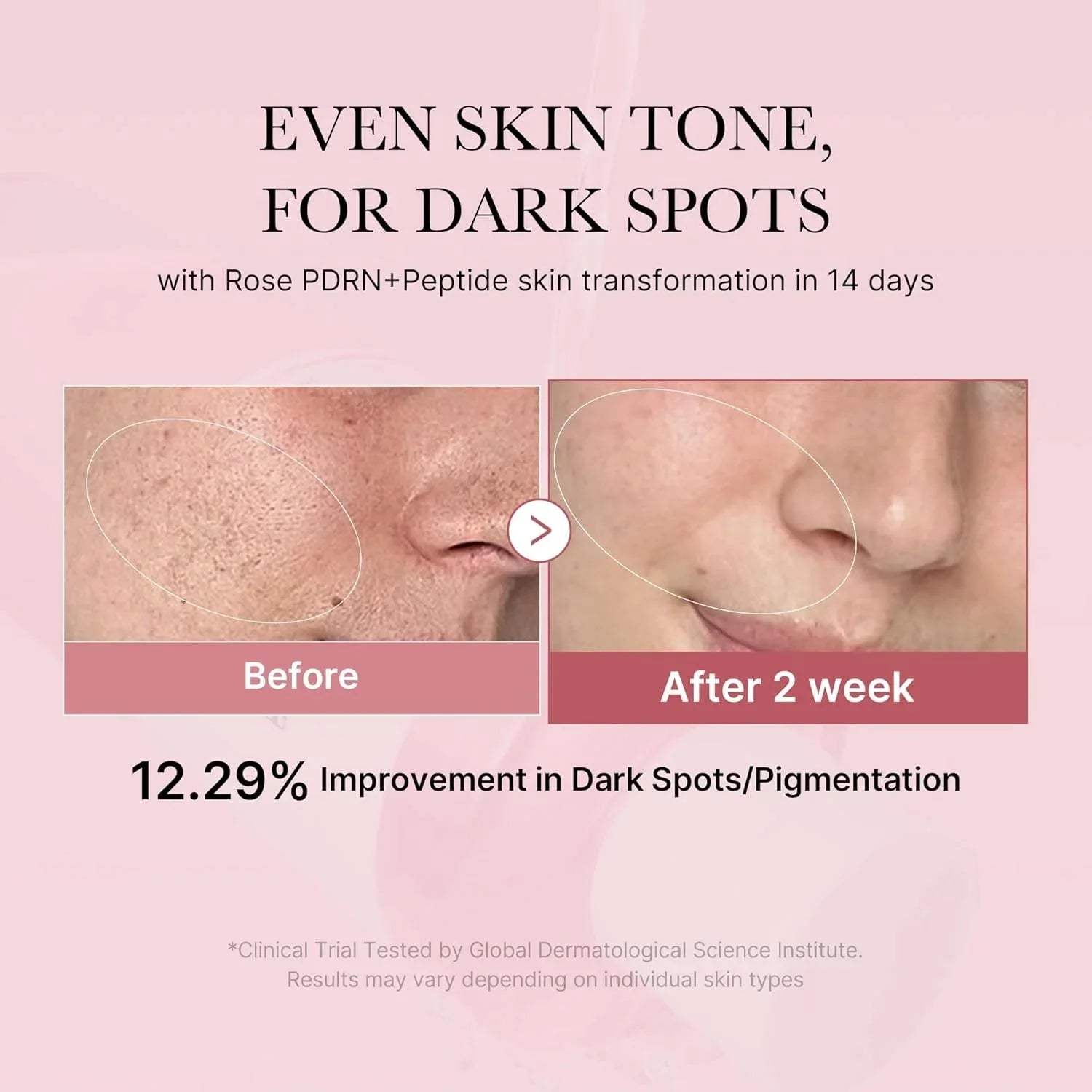 Medicube - PDRN Pink Niacinamide Milky Toner - 150ml | Tónico Facial Iluminador y Reparador