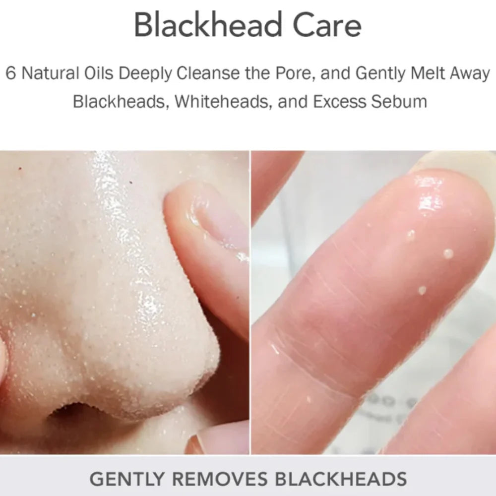 Celimax - Derma Nature Fresh Blackhead Jojoba Cleansing Oil - 150ml | Aceite Limpiador Desincrustante con Jojoba para Puntos Negros