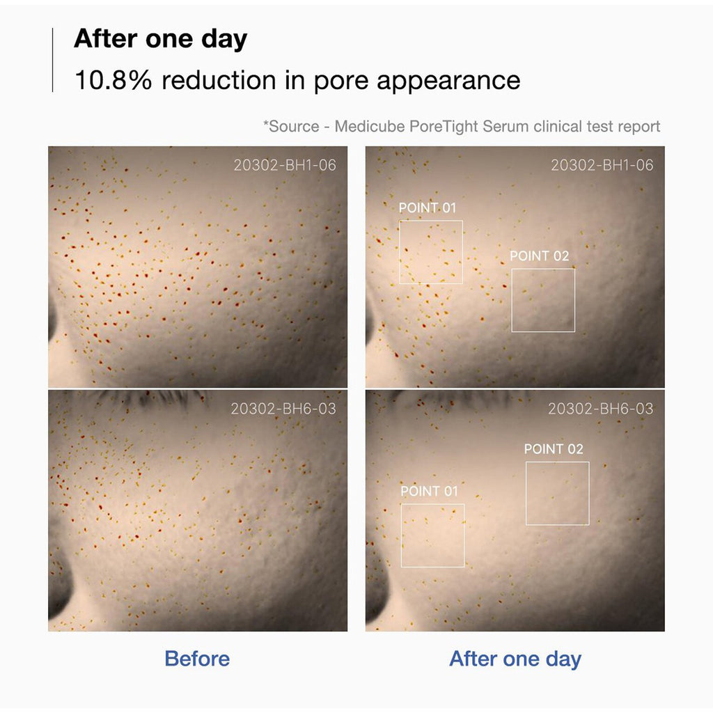 Medicube - Zero Pore One Day Peptide Serum - 30ml | Sérum Facial para Poros y Textura