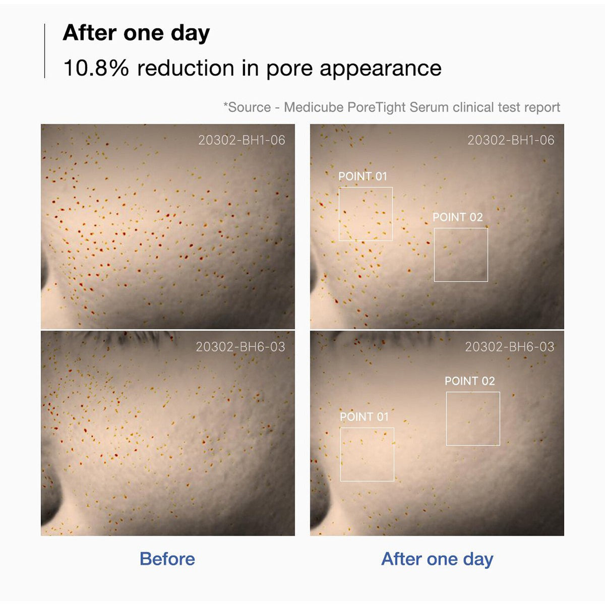 Medicube - Zero Pore One Day Peptide Serum - 30ml | Sérum Facial para Poros y Textura