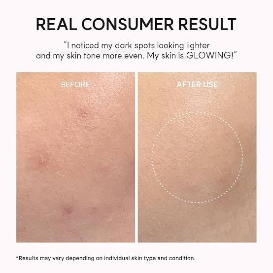 Arencia - Eraser Shot Glycolic Acid Exfoliator - 200ml | Exfoliante Facial con Ácido Glicólico
