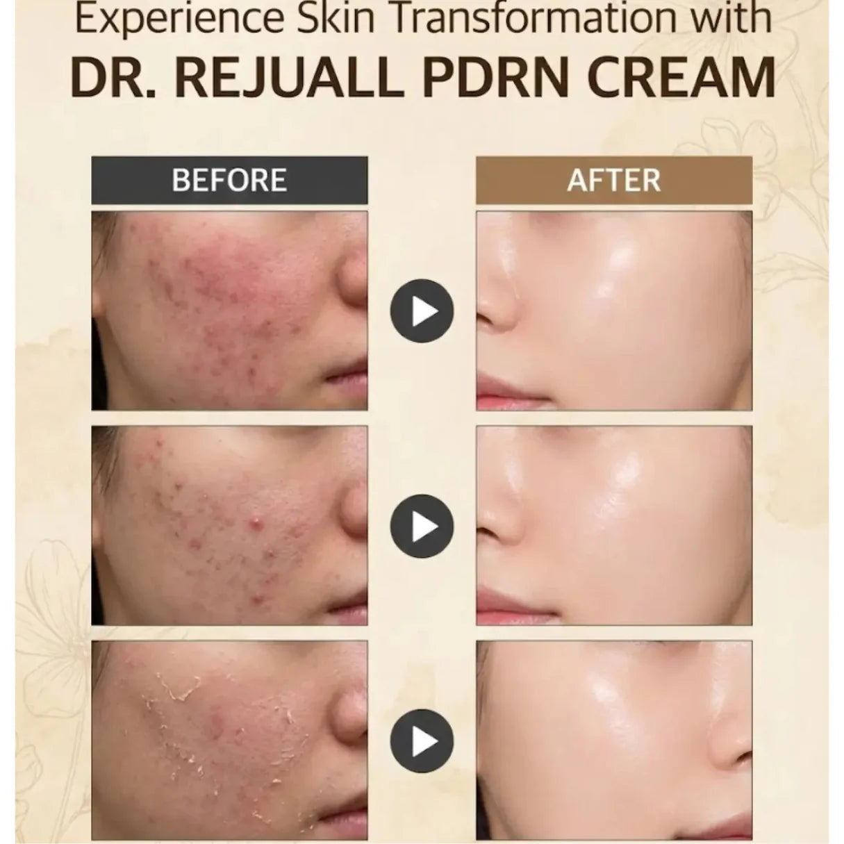 Dr. Reju-All - Advanced PDRN Rejuvenating Cream - 20ml | Crema Regeneradora Con PDRN Para Reparar Y Rejuvenecer La Piel