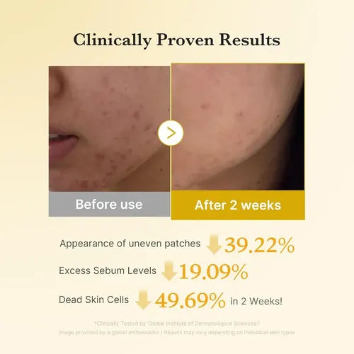 Medicube - Kojic Acid Turmeric Pad - 70 pads | Pads Exfoliantes E Iluminadores Con Ácido Kójico Y Cúrcuma Para Unificar El Tono De La Piel