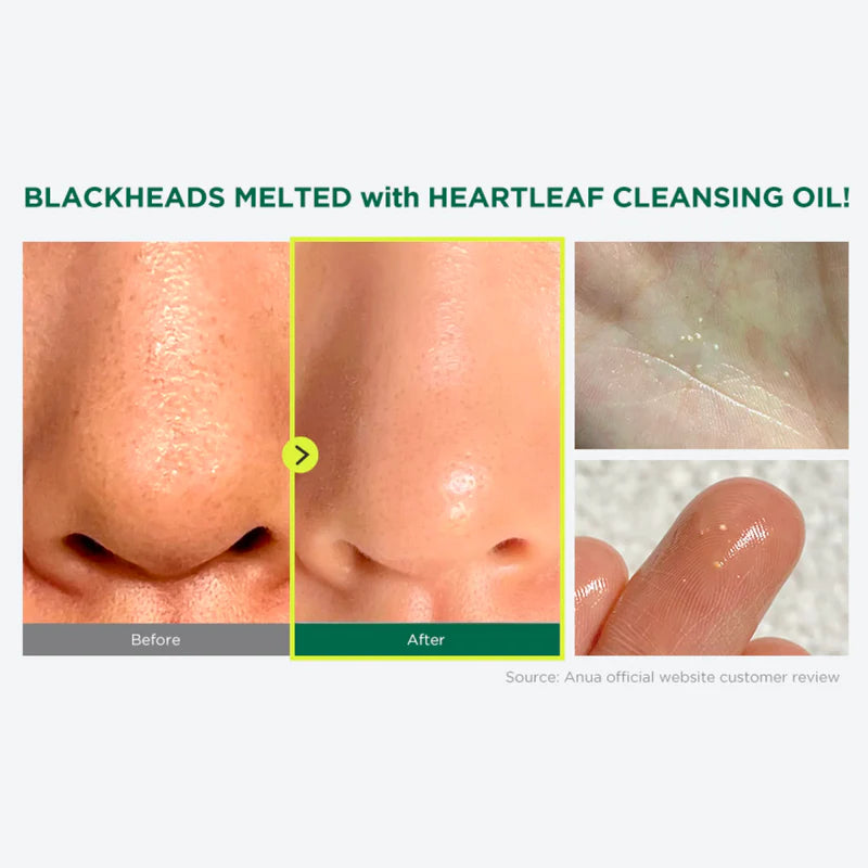 ANUA - Heartleaf Pore Control Cleansing Oil Mild - 200ml | Aceite Limpiador Elimina Sebo Impurezas