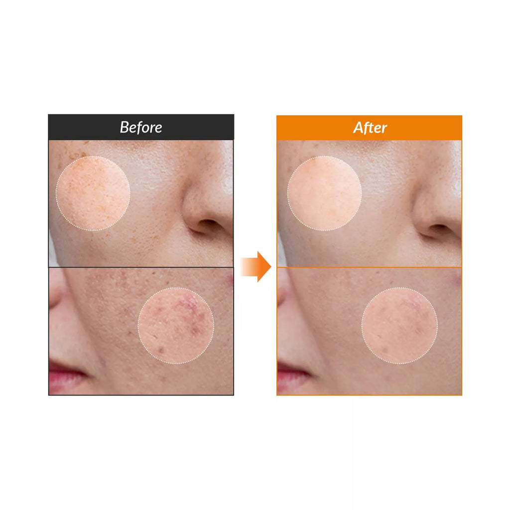 Dr. Althea - Vitamin C Boosting Serum - 30ml | Ilumina, Unifica y Reduce Manchas