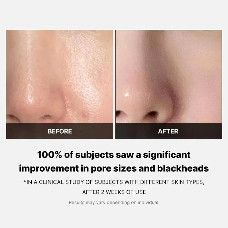 Medicube - Zero Pore Pad 2.0 - 70 pads | Almohadillas Exfoliantes que Reducen Poros y Mejoran la Textura