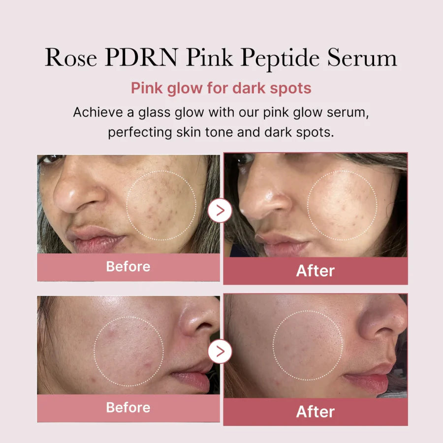 Medicube - PDRN Pink Peptide Serum - 30ml | Suero Rejuvenecedor con Péptidos y PDRN de Salmón