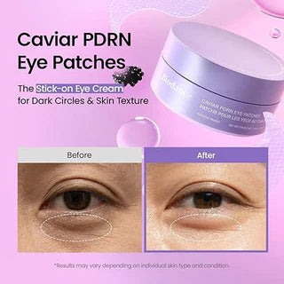 BIODANCE - Caviar PDRN Eye Patches - 30 pares | Parches para Ojos con PDRN para Hidratar y Reducir la Apariencia de Líneas Finas.