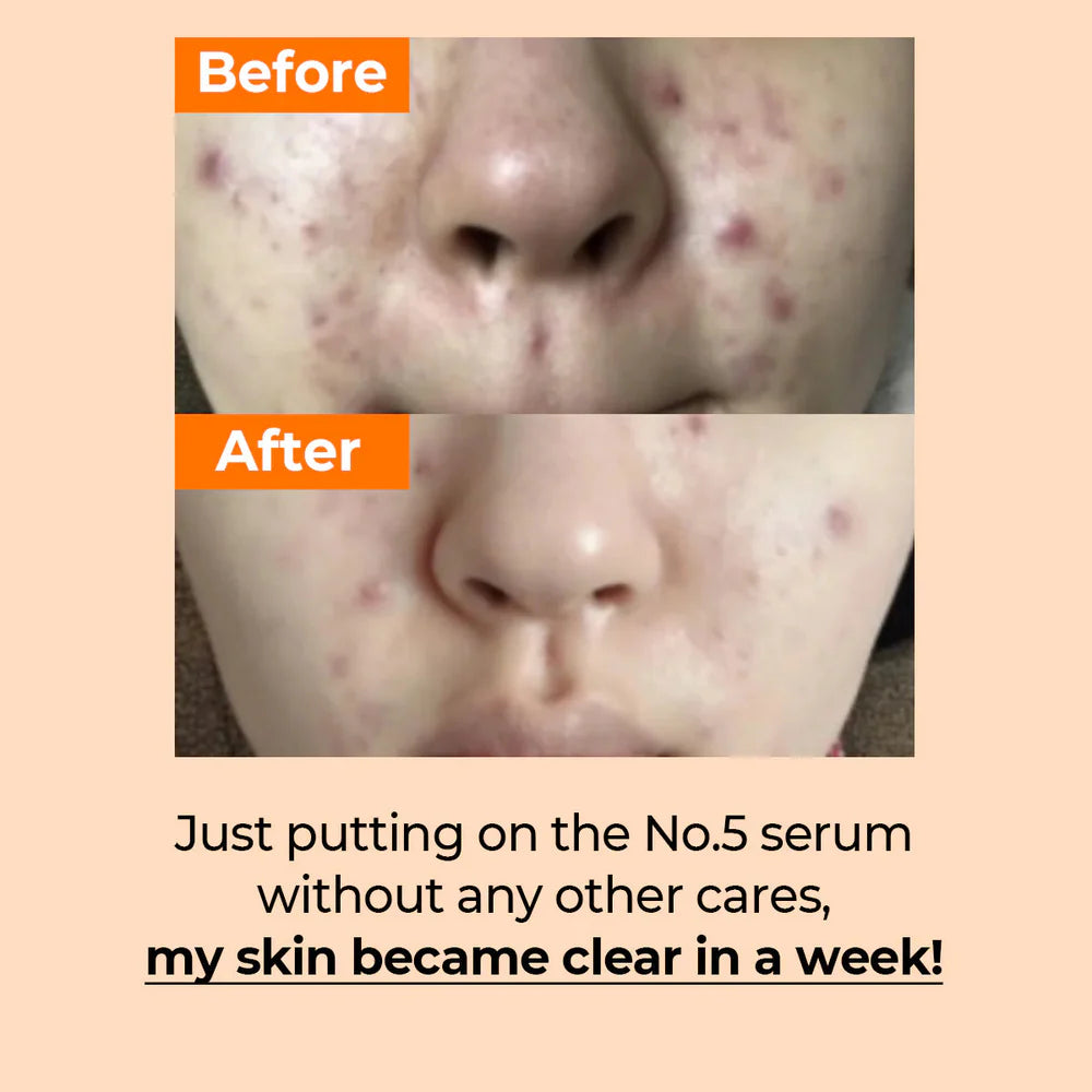 Numbuzin - No.5+ Glutathione Vitamin Concentrated Serum - 30ml | Sérum Iluminador para Manchas con Glutatión