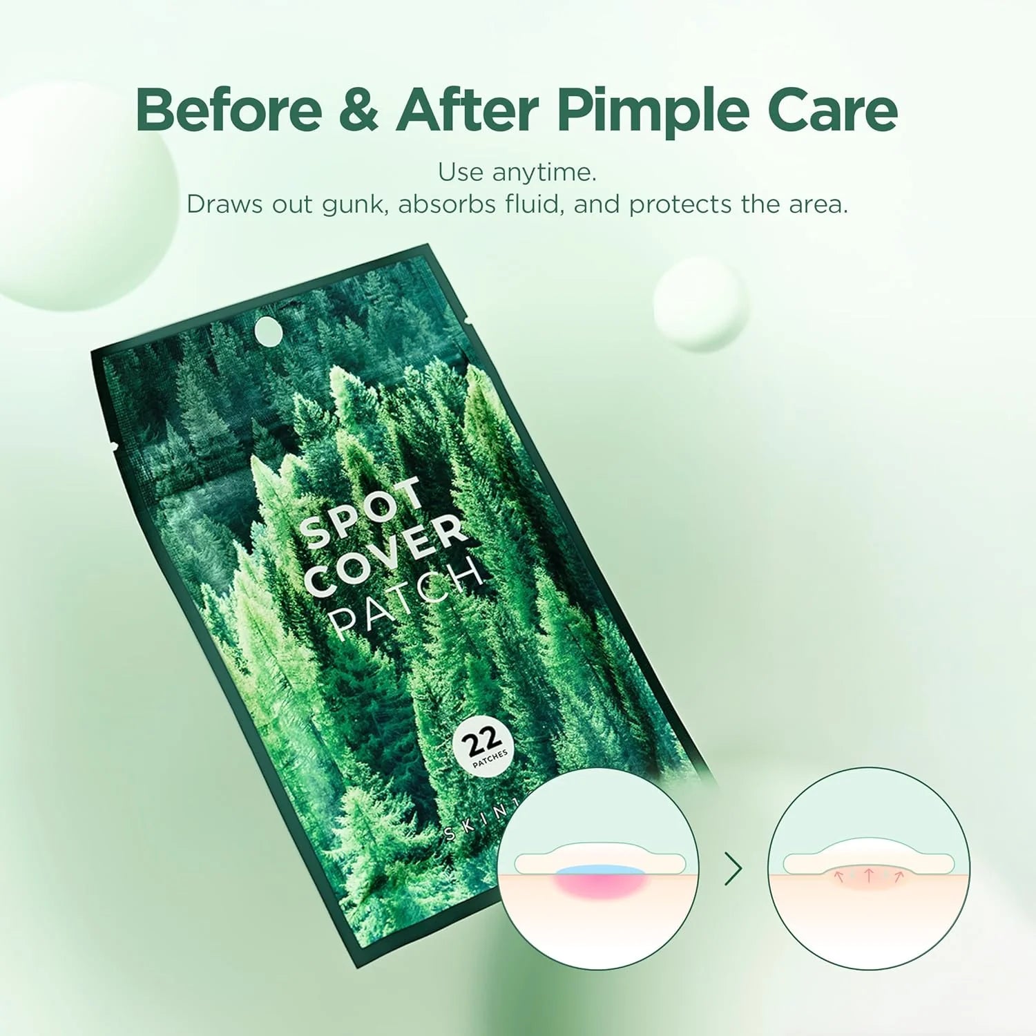 SKIN1004 - Spot Cover Patch - 22 piezas | Parches Antiacné para Granitos e Imperfecciones