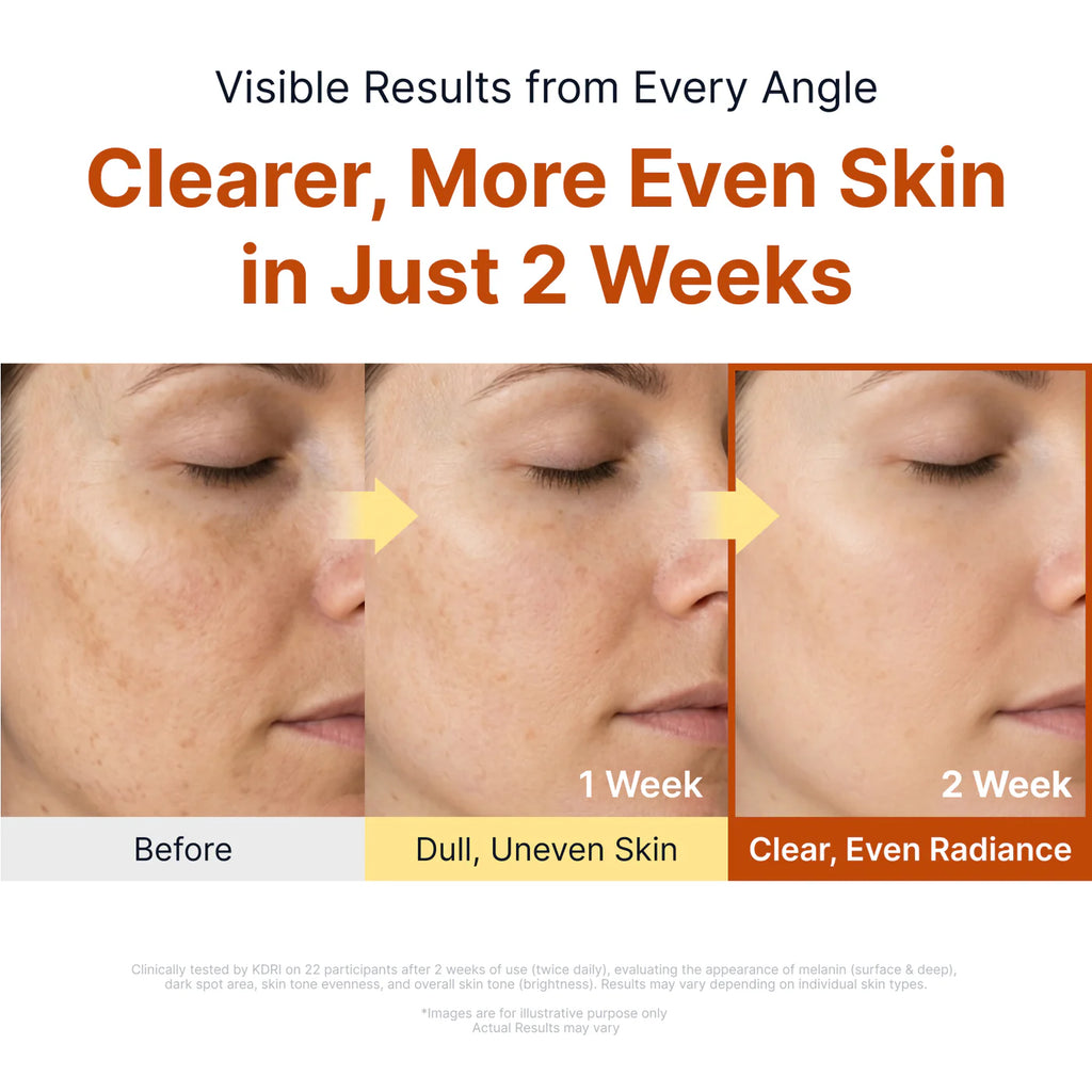 Sungboon Editor - Kojic Acid Niacinamide Brightening Ampoule - 40ml | Ampoule Iluminadora para Manchas con Ácido Kójico y Niacinamida