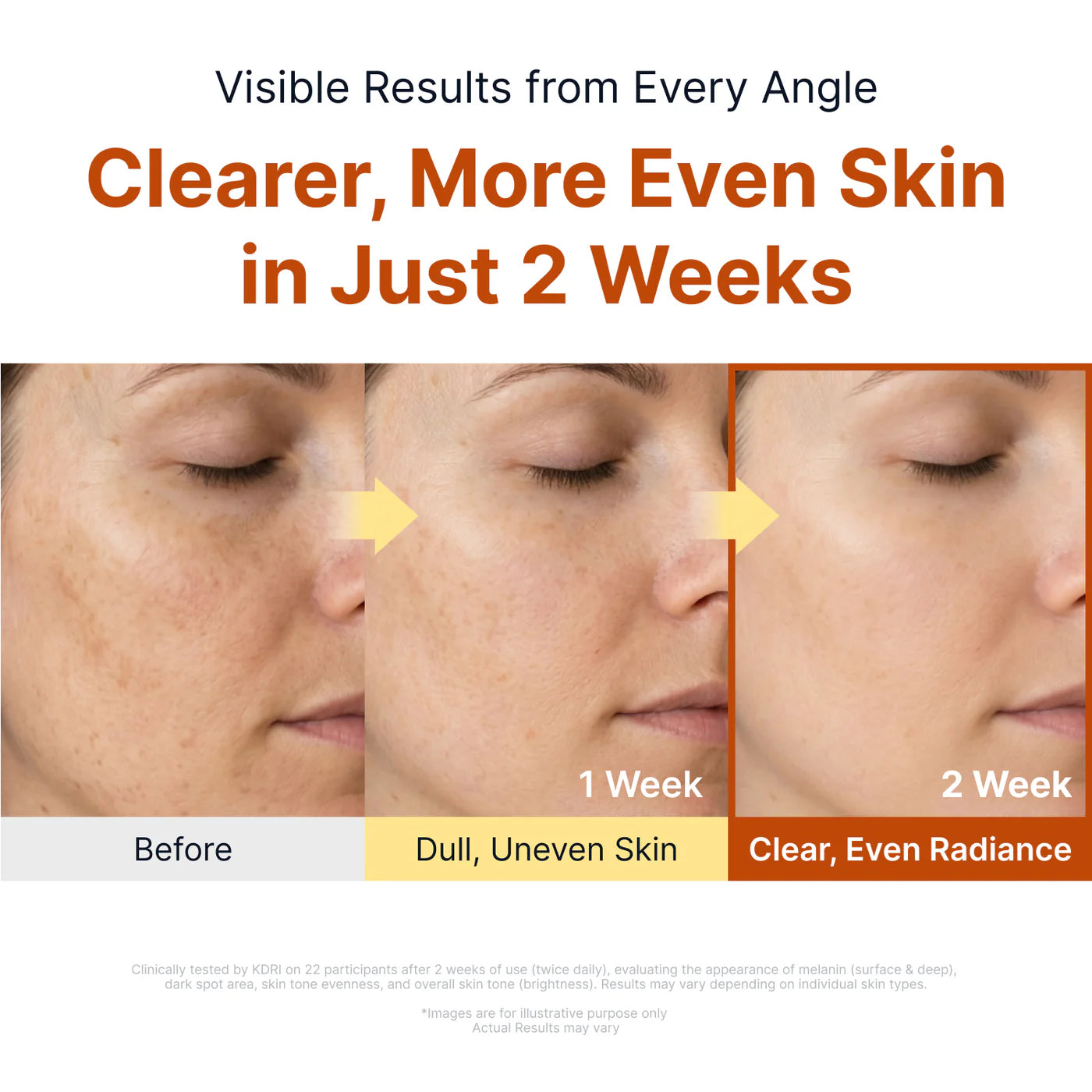 Sungboon Editor - Kojic Acid Niacinamide Brightening Ampoule - 40ml | Ampoule Iluminadora para Manchas con Ácido Kójico y Niacinamida