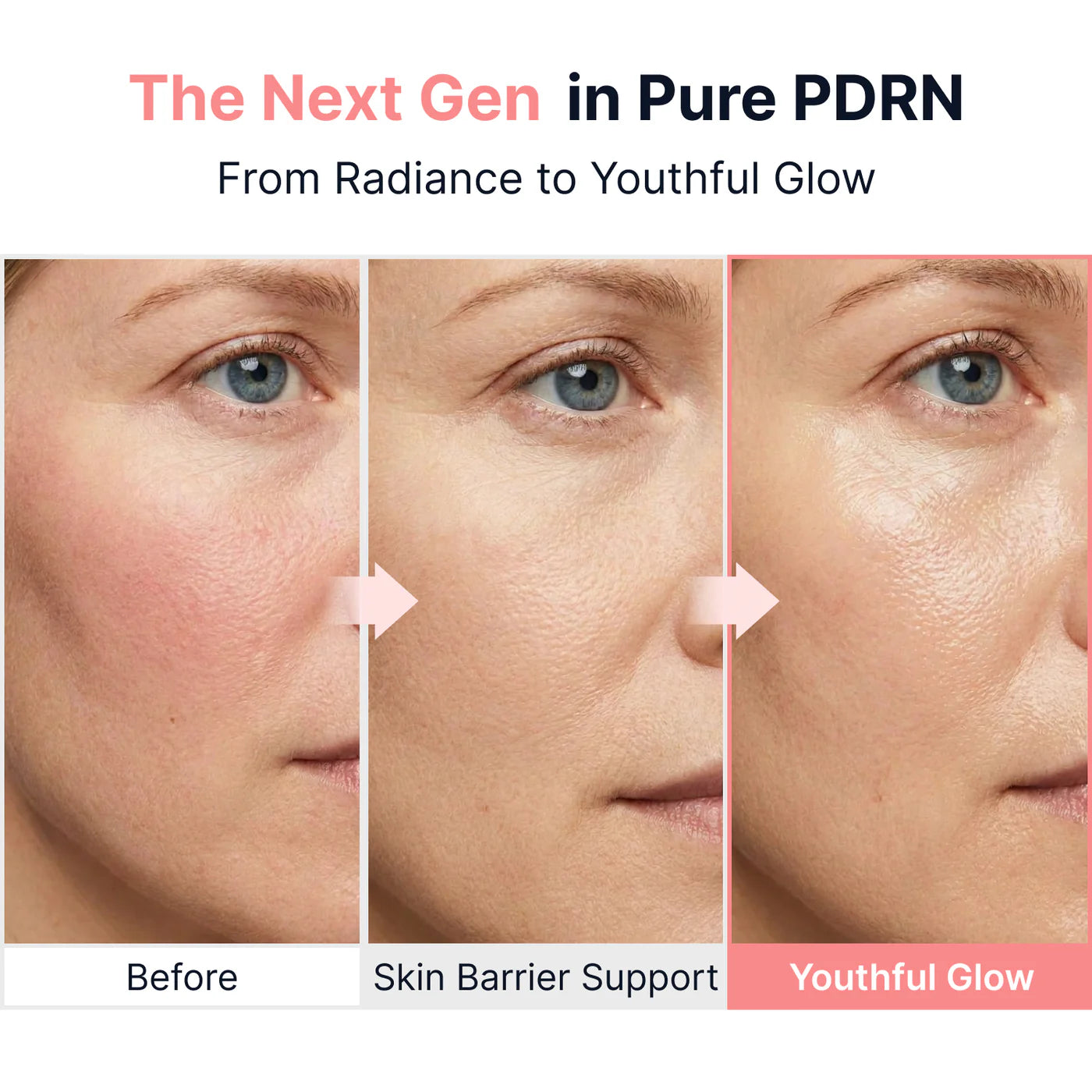 Sungboon Editor - PDRN Pink Vitamin Glow Boosting Ampoule - 40ml | Ampoule Iluminadora con PDRN y Vitaminas