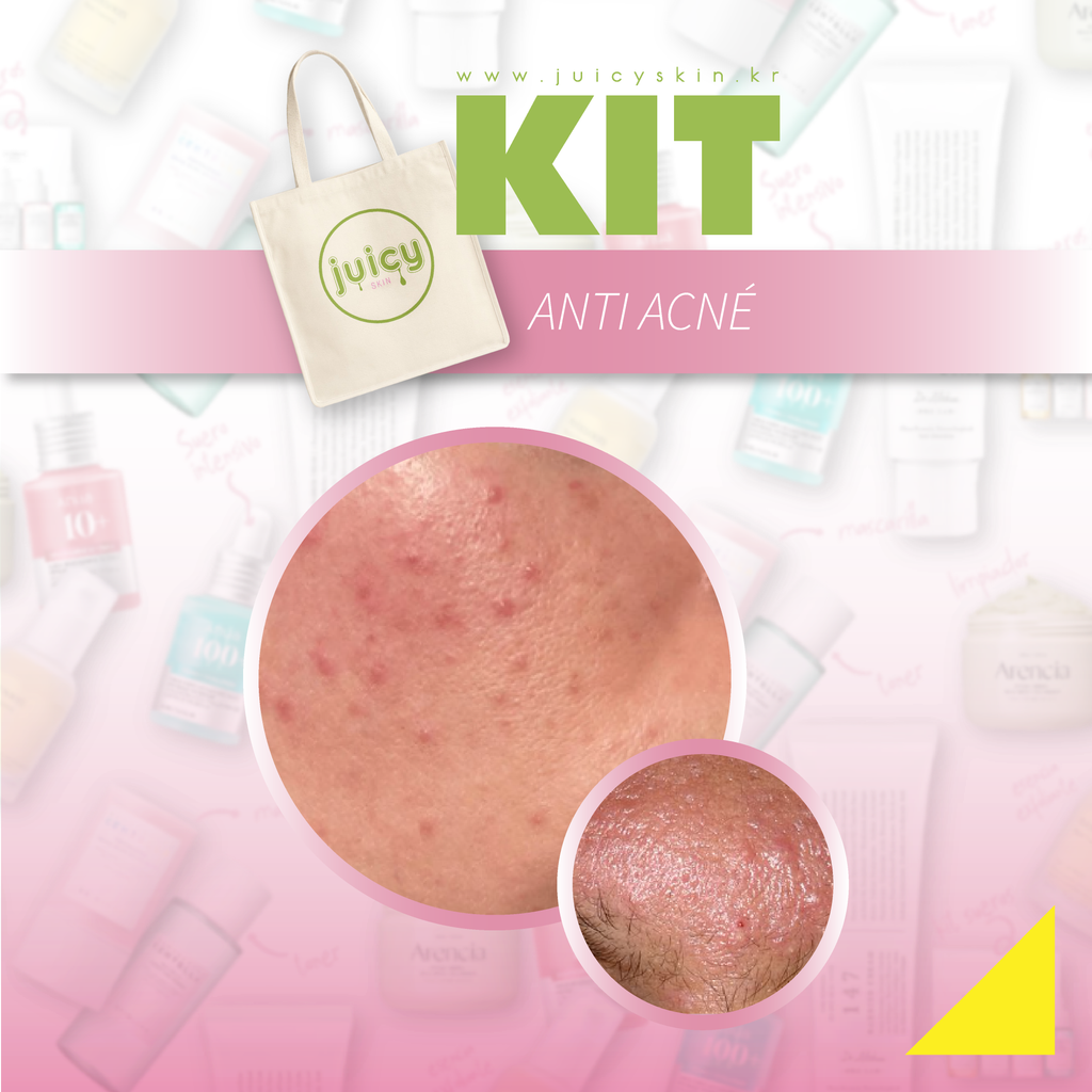 Kit Anti Acné | Purifica, Controla Brotes y Calma la Piel
