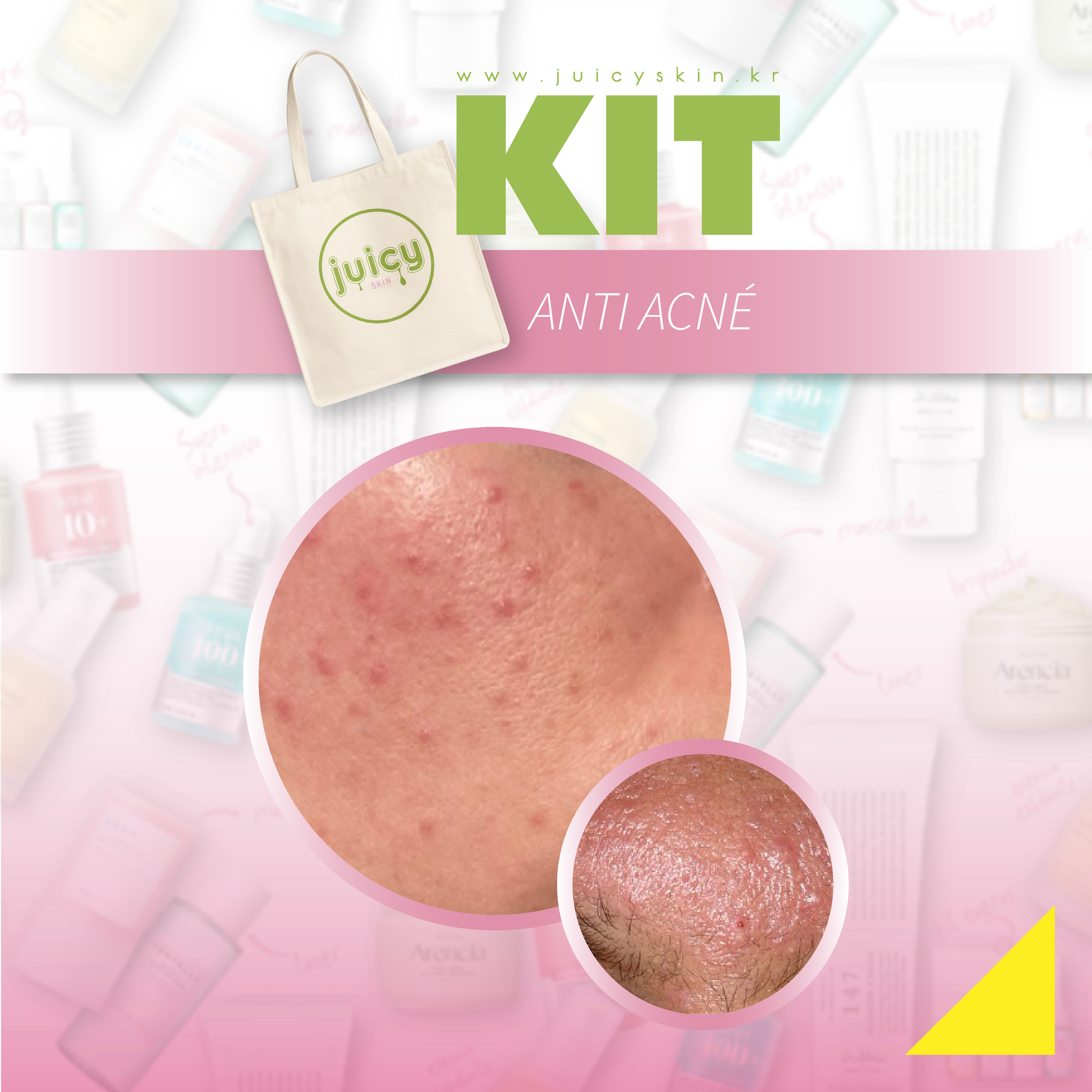 Kit Anti Acné | Purifica, Controla Brotes y Calma la Piel
